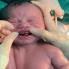 Bebê nasce com dentes em Campo Grande