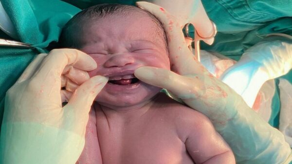 Bebê nasce com dentes em Campo Grande