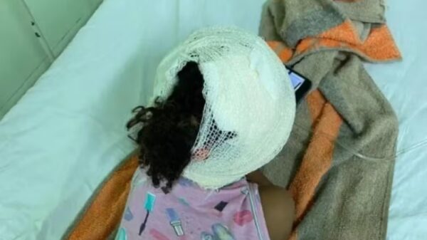 Menina de 3 anos fica com pescoço e cabeça ferida após ser atacada por Pitbull na calçada de casa no interior do Piauí