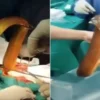 Homem enfia enguia viva de 60 cm no ânus e precisa passar por cirurgia após animal começar a comê-lo por dentro