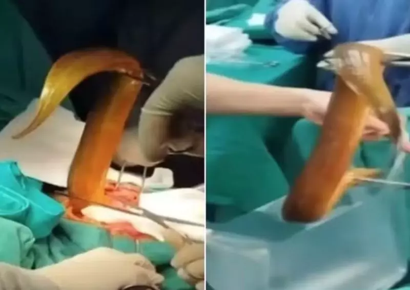 Homem enfia enguia viva de 60 cm no ânus e precisa passar por cirurgia após animal começar a comê-lo por dentro