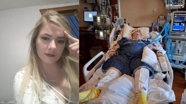 Mulher fica 11 dias em coma após colapso pulmonar causado por vape