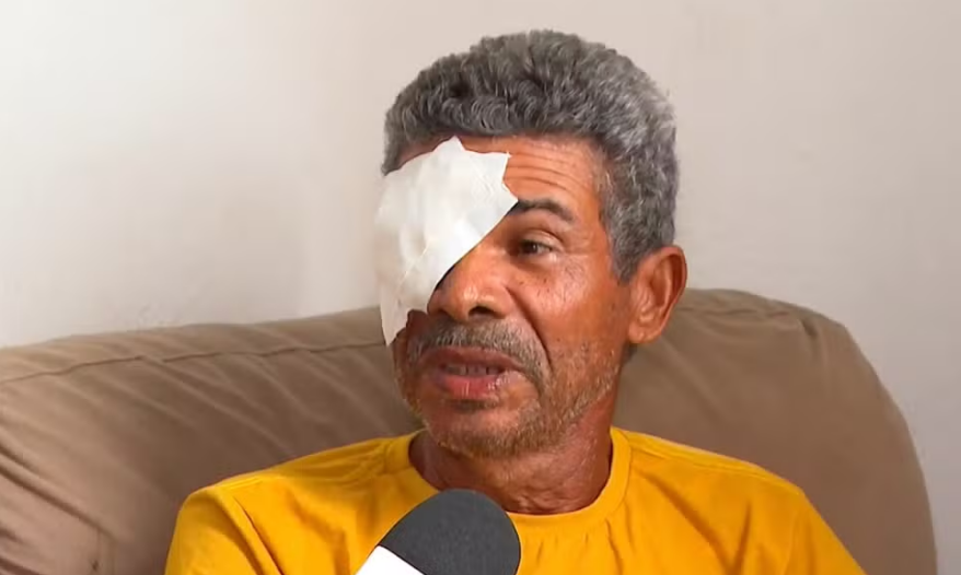 Sobe para 13 o número de pacientes que perderam a visão após mutirão em clínica de Salvador