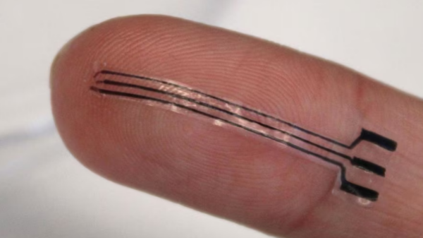 implante impresso em 3D reduz pressão arterial